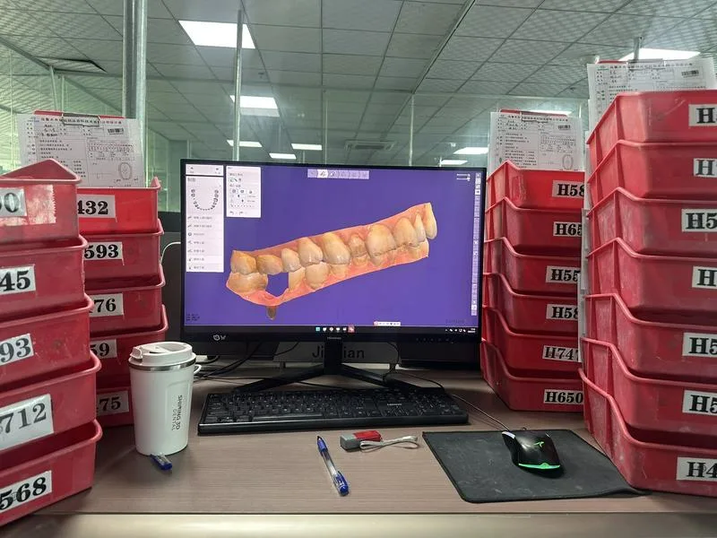您好我们生产🦷假牙的公司总部在乌鲁木齐 哈萨克斯坦有分公司，如果在乌兹别克跟我我们合作做牙的可以联系我们，如果口腔科有口扫仪，就提供给我口扫数据我们就可以生产，