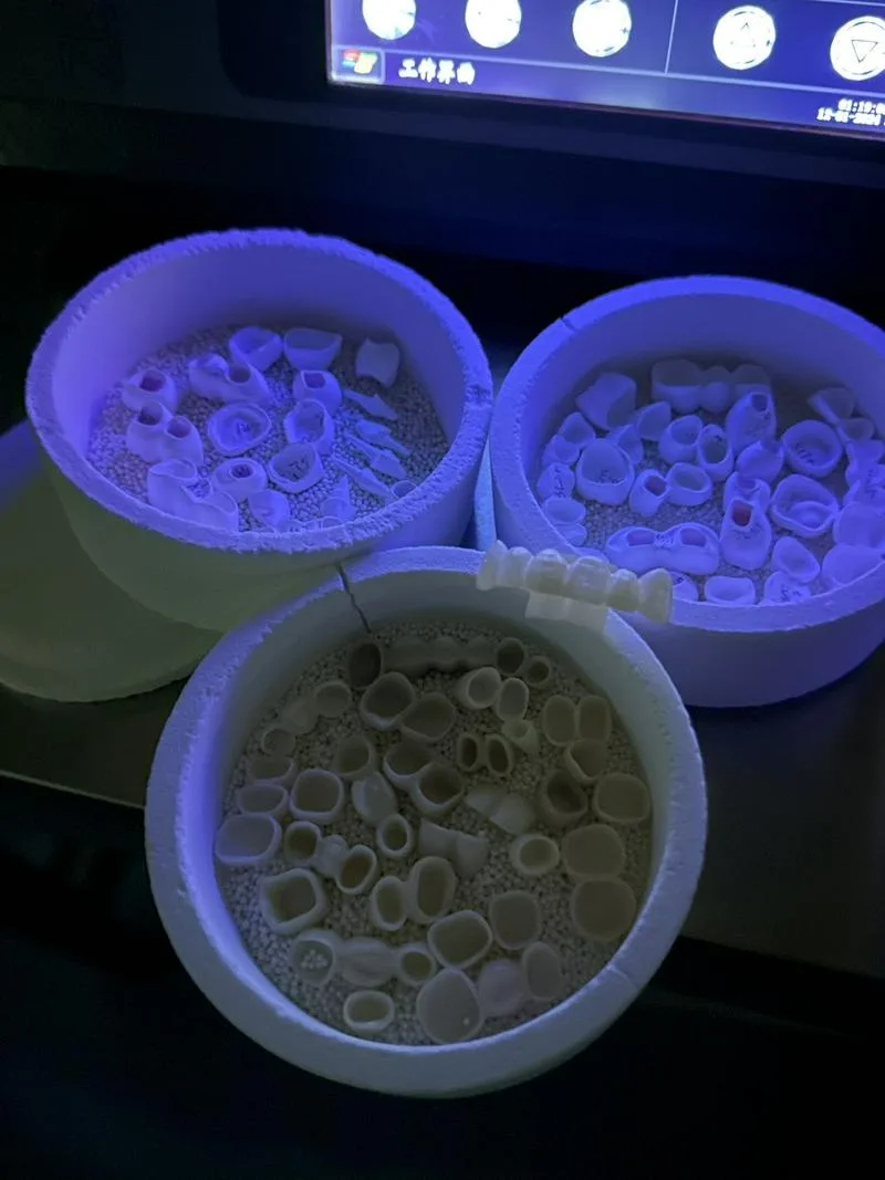 您好我们生产🦷假牙的公司总部在乌鲁木齐 哈萨克斯坦有分公司，如果在乌兹别克跟我我们合作做牙的可以联系我们，如果口腔科有口扫仪，就提供给我口扫数据我们就可以生产，