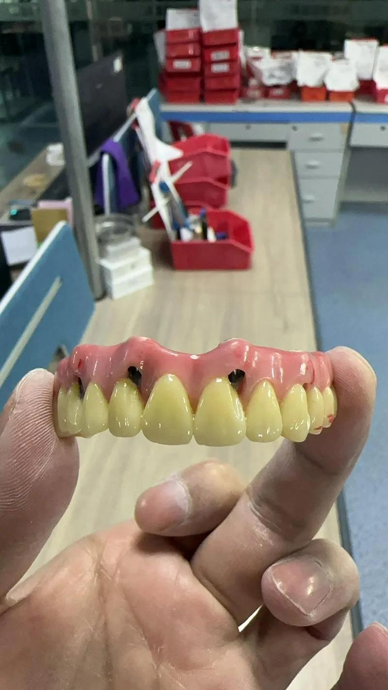 您好我们生产🦷假牙的公司总部在乌鲁木齐 哈萨克斯坦有分公司，如果在乌兹别克跟我我们合作做牙的可以联系我们，如果口腔科有口扫仪，就提供给我口扫数据我们就可以生产，